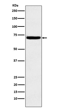 Heparanase 1 HPSE Monoclonal Antibody