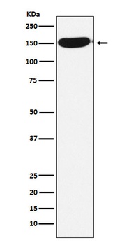 Anti-CPS1 Monoclonal Antibody