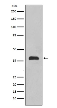 TTF1 NKX2-1 Rabbit Monoclonal Antibody