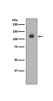 Neuropilin 1 NRP1 Rabbit Monoclonal Antibody