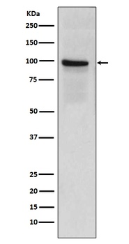 Anti-Thrombomodulin THBD Rabbit Monoclonal Antibody