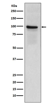 Thrombomodulin THBD Rabbit Monoclonal Antibody