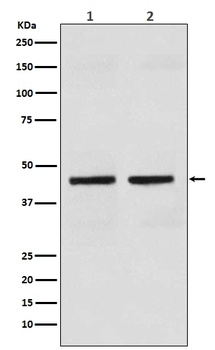 Anti-Cytokeratin 18 KRT18 Rabbit Monoclonal Antibody
