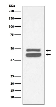 Anti-Cytokeratin 18 Krt18 Rabbit Monoclonal Antibody