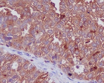 Anti-Cathepsin D CTSD Rabbit Monoclonal Antibody