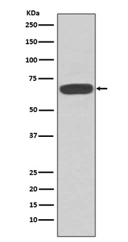 PKR EIF2AK2 Rabbit Monoclonal Antibody