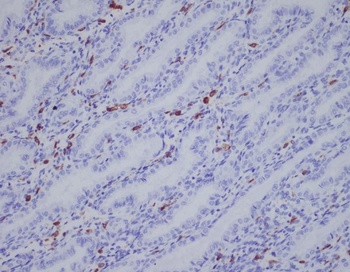 Anti-IBA1 AIF1 Monoclonal Antibody