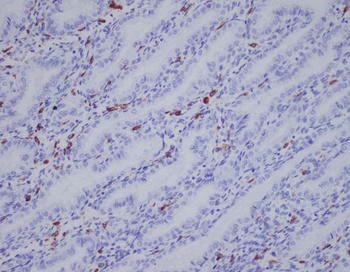 IBA1 AIF1 Monoclonal Antibody