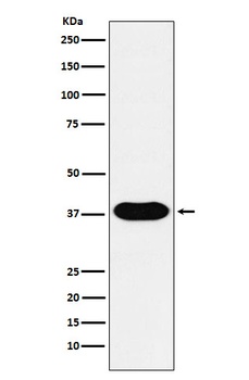 CD79B Monoclonal Antibody
