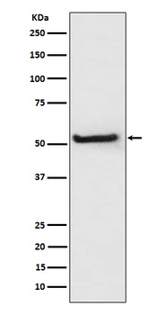 TXNIP Monoclonal Antibody