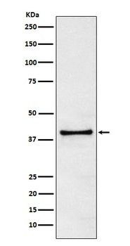 Anti-TRIB3 Monoclonal Antibody
