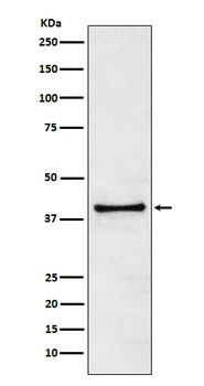 TRIB3 Monoclonal Antibody