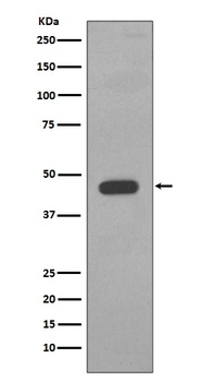 Cytokeratin 14 KRT14 Rabbit Monoclonal Antibody