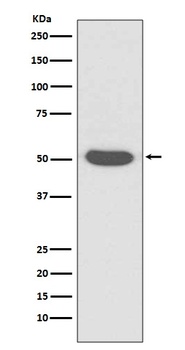 Cytokeratin 14 KRT14 Rabbit Monoclonal Antibody