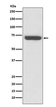 TNF Receptor II TNFRSF1B Rabbit Monoclonal Antibody
