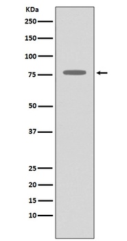 Anti-GRK2 ADRBK1 Rabbit Monoclonal Antibody