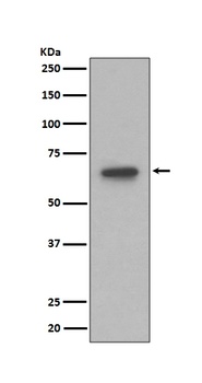 S6K1 RPS6KB1 Rabbit Monoclonal Antibody