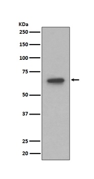 Anti-S6K1 RPS6KB1 Rabbit Monoclonal Antibody