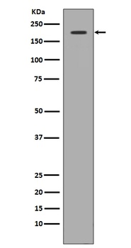 Anti-Met (c-Met) Rabbit Monoclonal Antibody
