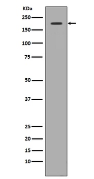 Met (c-Met) Rabbit Monoclonal Antibody