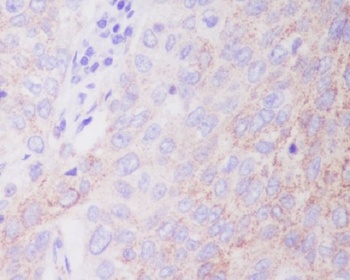 Anti-Hexokinase 1 HK1 Rabbit Monoclonal Antibody