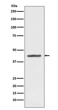 Anti-HMBS Rabbit Monoclonal Antibody