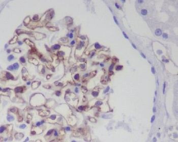 CD31 PECAM1 Rabbit Monoclonal Antibody