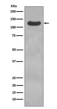 CD31 PECAM1 Rabbit Monoclonal Antibody