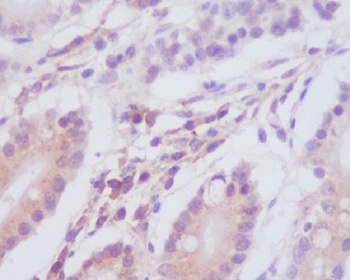 MAP1LC3A/Lc3A Rabbit Monoclonal Antibody