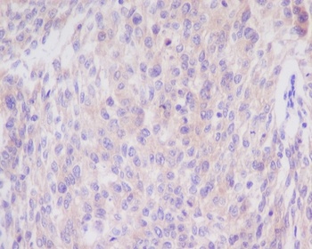 Anti-Bim BCL2L11 Rabbit Monoclonal Antibody