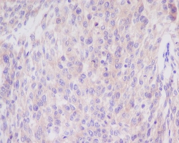 Bim BCL2L11 Rabbit Monoclonal Antibody