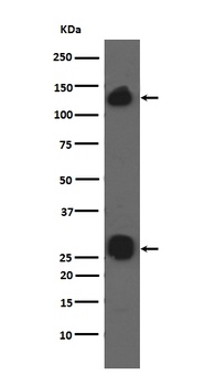Anti-Integrin alpha V ITGAV Rabbit Monoclonal Antibody
