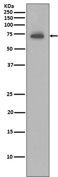 Anti-IAP2 BIRC3 Rabbit Monoclonal Antibody