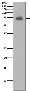 IAP2 BIRC3 Rabbit Monoclonal Antibody