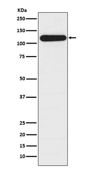 Anti-BubR1 BUB1B Rabbit Monoclonal Antibody