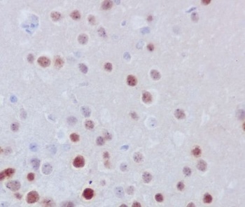 Anti-Fos B Rabbit Monoclonal Antibody