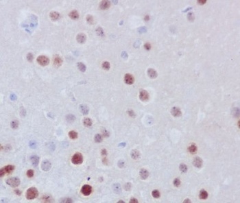 Fos B Rabbit Monoclonal Antibody