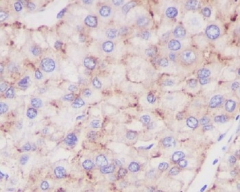 LAMP2a Rabbit Monoclonal Antibody