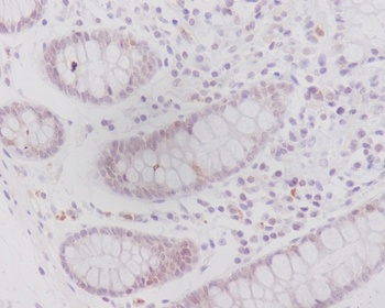 Anti-Caveolin-2 CAV2 Rabbit Monoclonal Antibody