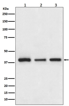 Cathepsin L/V/K/H Rabbit Monoclonal Antibody