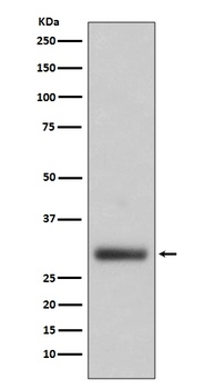 Neutrophil Elastase ELANE Rabbit Monoclonal Antibody