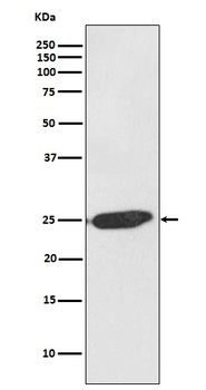 SNAP25 Rabbit Monoclonal Antibody