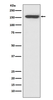 Anti-CD21 CR2 Rabbit Monoclonal Antibody