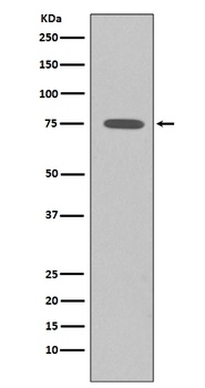 Anti-Somatostatin Receptor 2 SSTR2 Rabbit Monoclonal Antibody