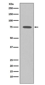 Somatostatin Receptor 2 SSTR2 Rabbit Monoclonal Antibody