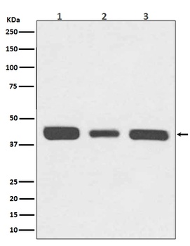 67kDa Laminin Receptor RPSA Rabbit Monoclonal Antibody
