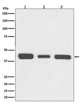 Anti-67kDa Laminin Receptor RPSA Rabbit Monoclonal Antibody