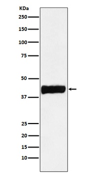 Anti-Creatine kinase B type CKB Monoclonal Antibody