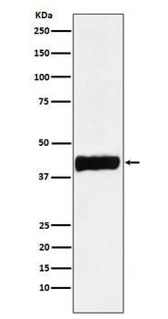 Creatine kinase B type CKB Monoclonal Antibody