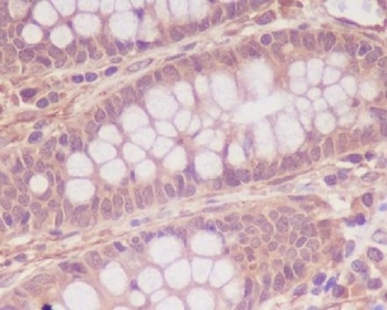 Anti-Myosin light chain kinase MYLK Rabbit Monoclonal Antibody